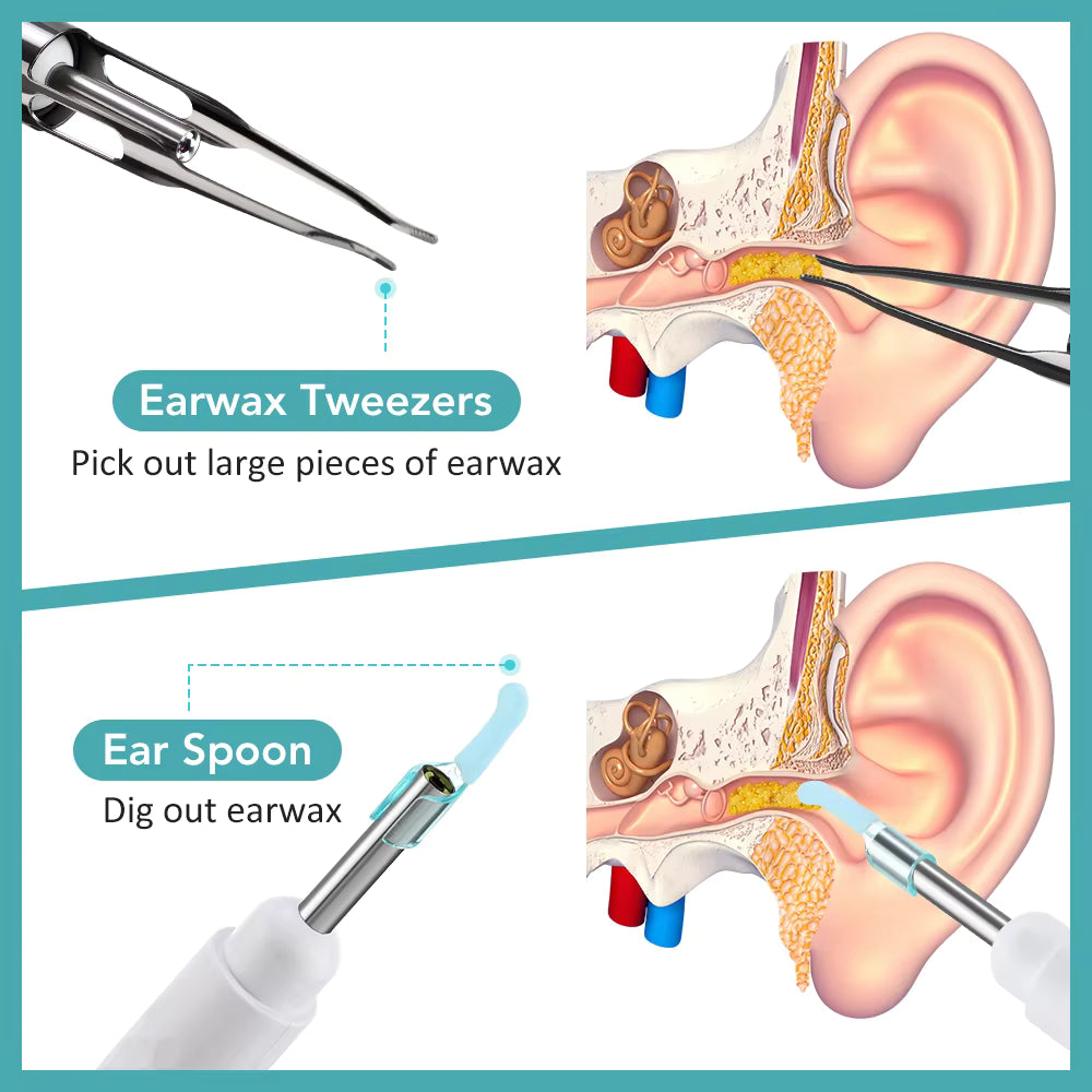 2-in-1 Visual Earwax Cleaner with 1080P HD Camera & Tweezers Kit