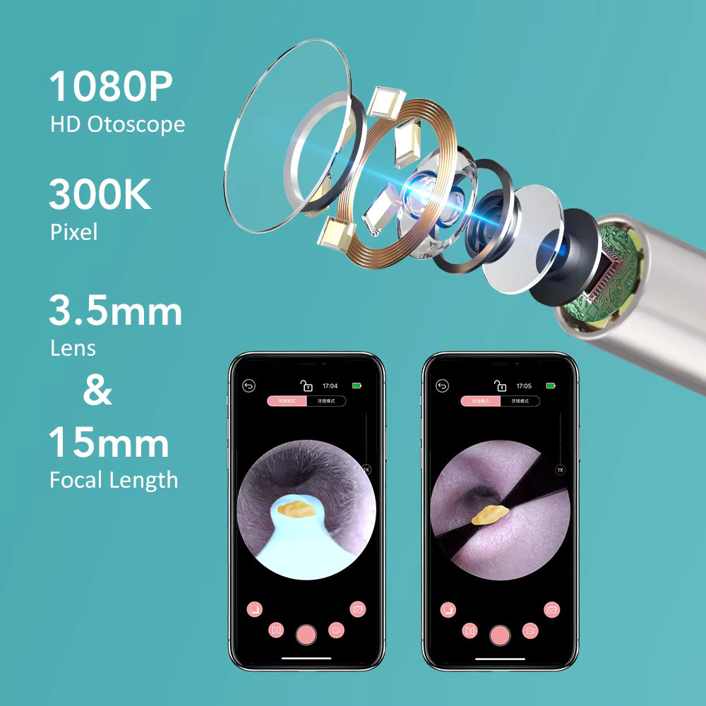 2-in-1 Visual Earwax Cleaner with 1080P HD Camera & Tweezers Kit