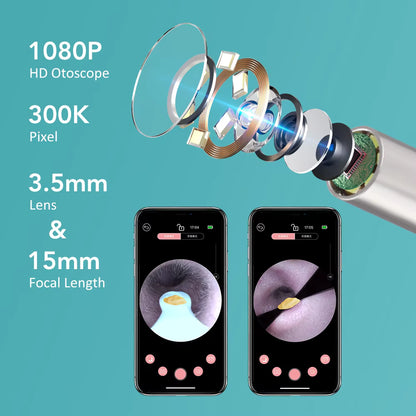2-in-1 Visual Earwax Cleaner with 1080P HD Camera & Tweezers Kit